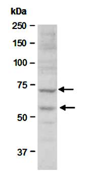 TP63 (N) Antibody, Rabbit Polyclonal