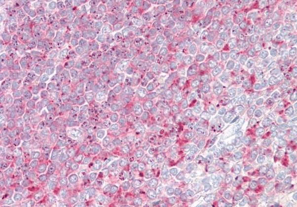 Goat anti-TPD52 Antibody