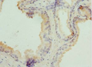 TPD52L1 antibody