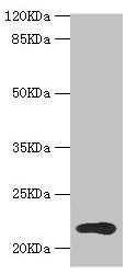 TPD52L1 antibody