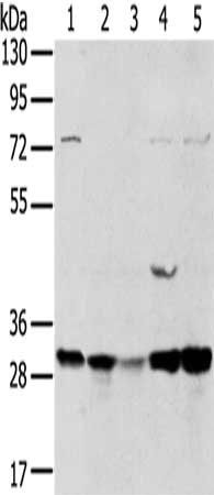 TPD52L2 antibody