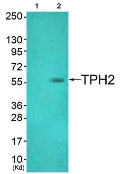 TPH2 (Ab-19) Antibody