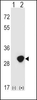 TPI1 antibody
