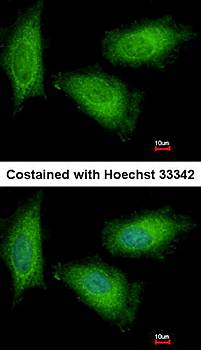 TPI1 Rabbit Polyclonal Antibody