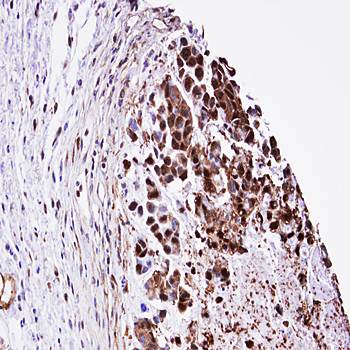 TPI1 Rabbit Polyclonal Antibody
