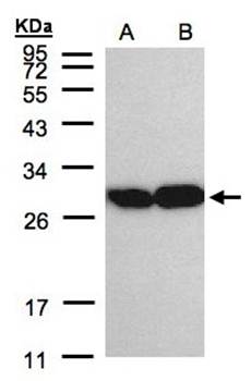 TPI1 Rabbit Polyclonal Antibody