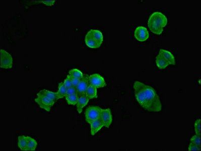 TPK1 Antibody
