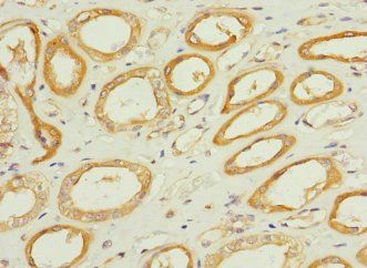 TPK1 Antibody
