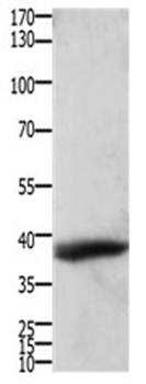 TPM2 Rabbit Polyclonal Antibody
