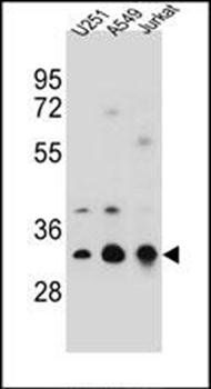 TPM4 antibody