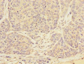 TPM4 Antibody
