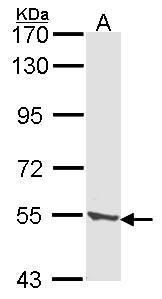 tripeptidyl peptidase 1 Antibody