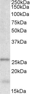 Goat anti-TPPP/p25 Antibody