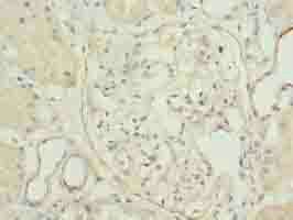 TPPP2 Antibody