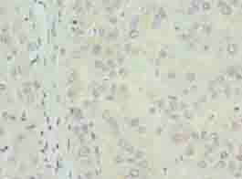 TPPP2 Antibody
