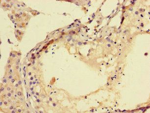 TPPP3 Antibody