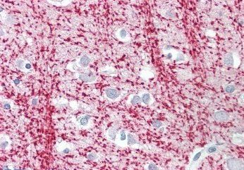 Goat anti-TPPP/p25 Antibody