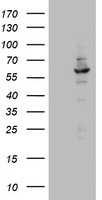TPRKB Antibody