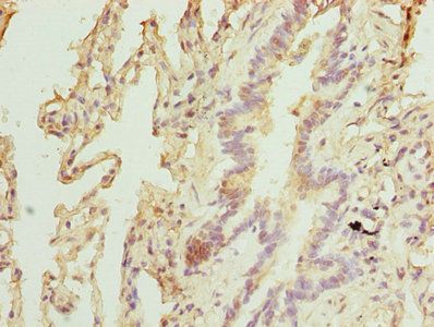 TPRKB Antibody