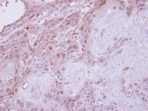 TPRKB antibody