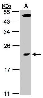 TP53RK binding protein Antibody
