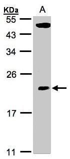 TPRKB antibody