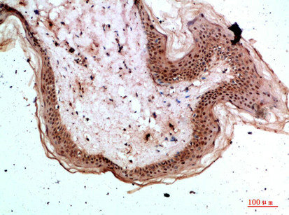 TPSD1 Antibody