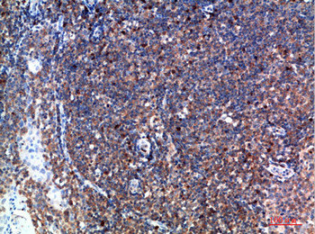 TPSD1 Antibody