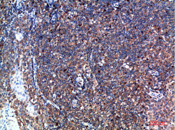 TPSD1 antibody