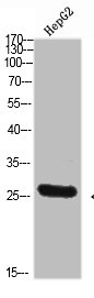 TPSD1 Antibody