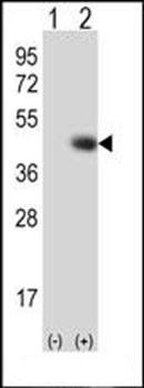 TPST1 antibody