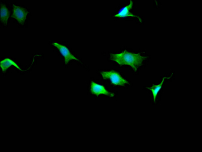 TPT1 Recombinant Monoclonal Antibody