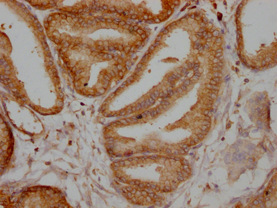 TPT1 Recombinant Monoclonal Antibody