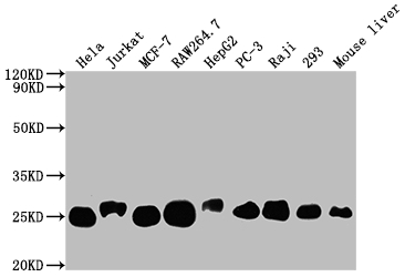 TPT1 Recombinant Monoclonal Antibody