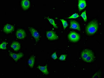 TPT1P8 Antibody
