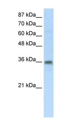 TRA2B antibody