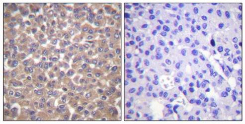 TRADD antibody