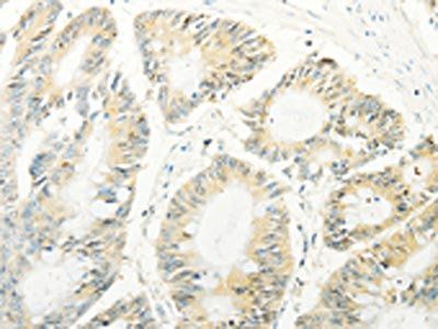 TRAF1 Antibody