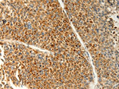 TRAF1 antibody