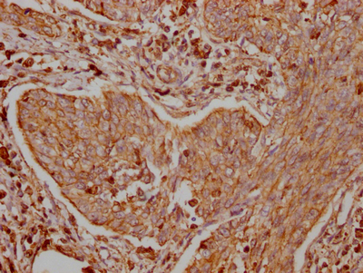 TRAF2 Recombinant Monoclonal Antibody