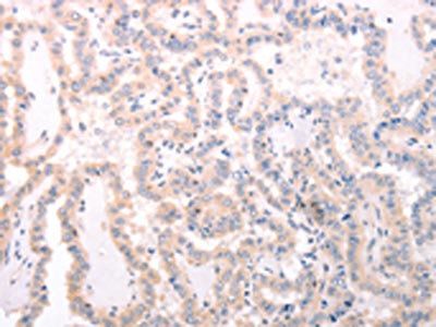 TRAF3IP1 Antibody
