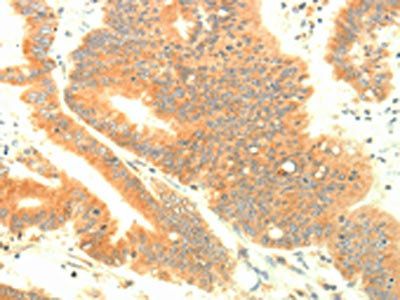 TRAF3IP2 Antibody
