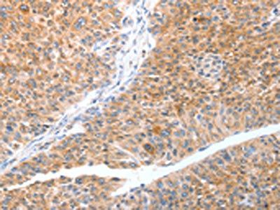 TRAF3IP3 Antibody