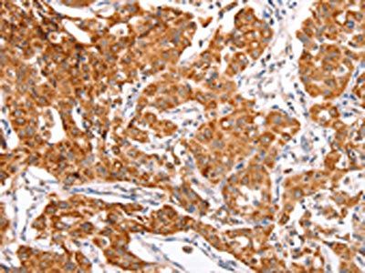 TRAF5 Antibody