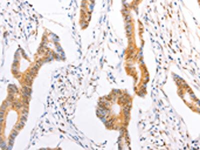 TRAF5 Antibody