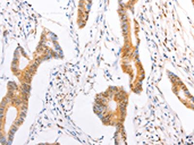 TRAF5 antibody