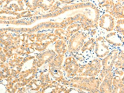 TRAF6 Antibody