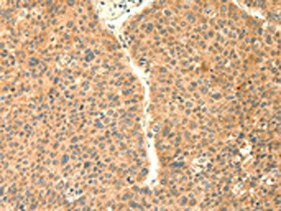 TRAF6 Antibody