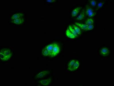 TRAF7 antibody