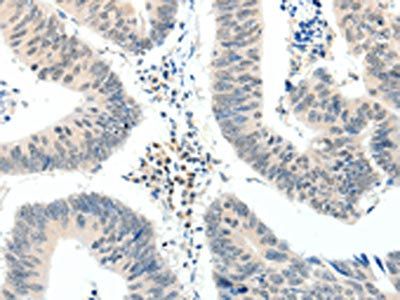 TRAF7 Antibody